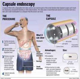 Capsule endoscopy in kalyan