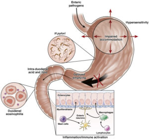 DYSPEPSIA-GUIDE